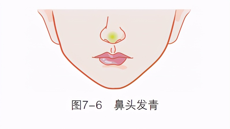 鼻子没嗅觉是梅毒引起的吗,鼻子出现梅毒症状