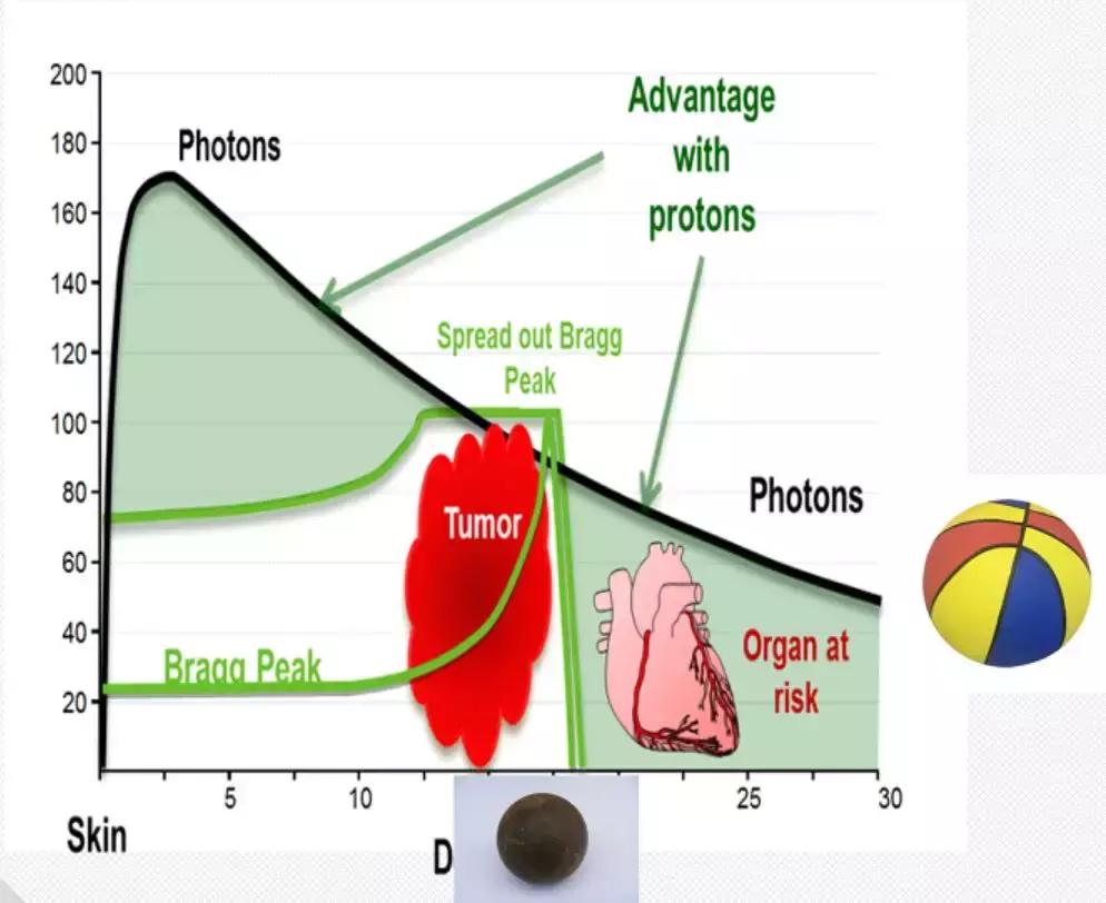 成年人眼癌的最新治疗方法,眼睛长肿瘤怎么治疗