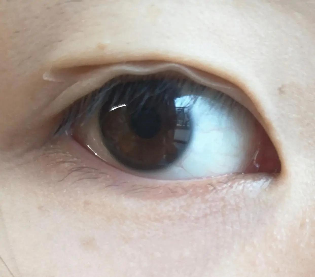 单眼皮垂眼怎么拯救,单眼皮怎么拯救