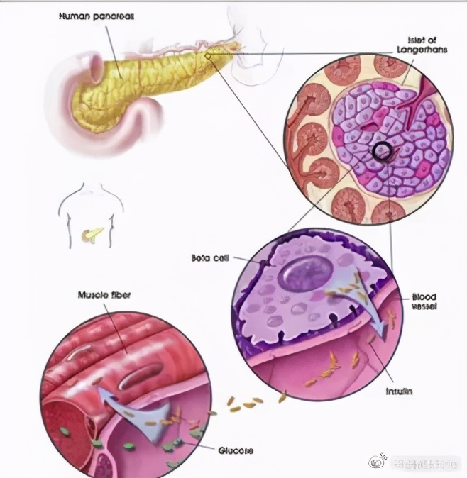 最新干细胞治疗糖尿病,世界干细胞治疗糖尿病最新成果