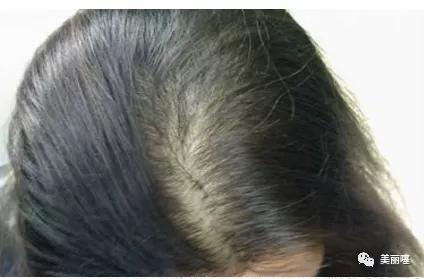 江疏影换发型视频,江疏影短发变长