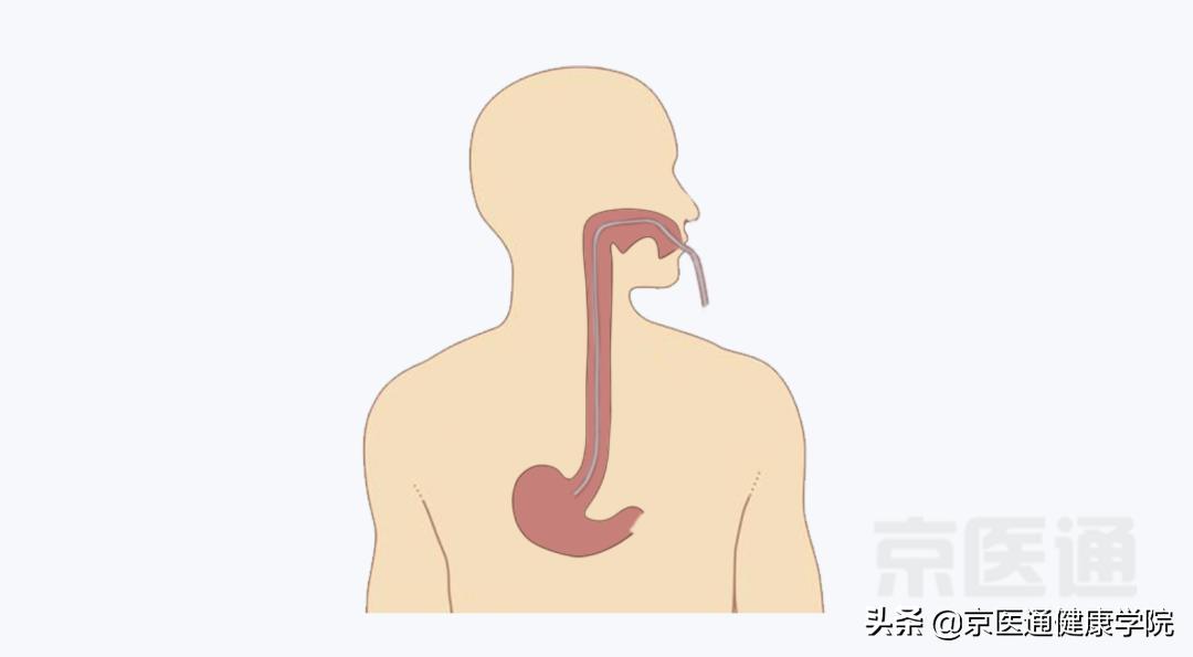 胃镜鼻腔镜,胃镜和肠镜以及胃肠镜的区别