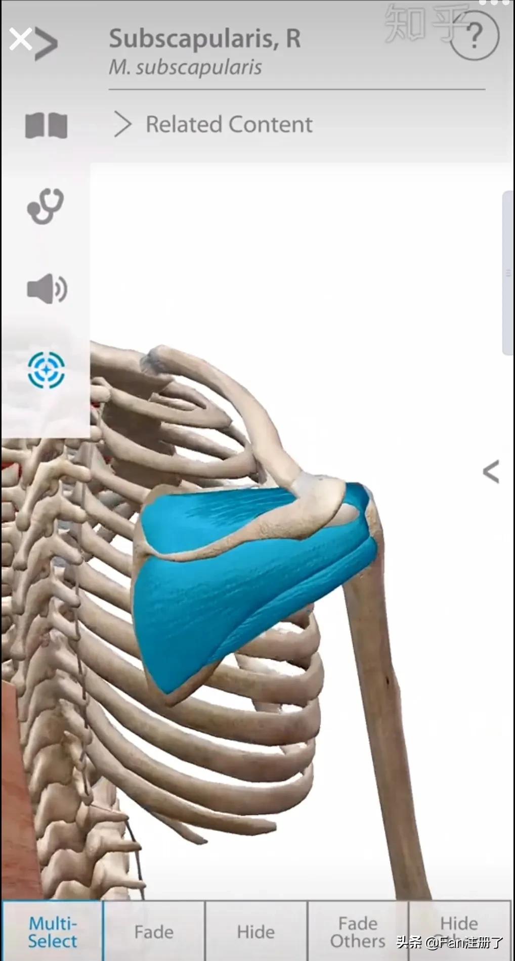 肩痛肩袖损伤针刀治疗,肩痛肩关节活动受限用什么药