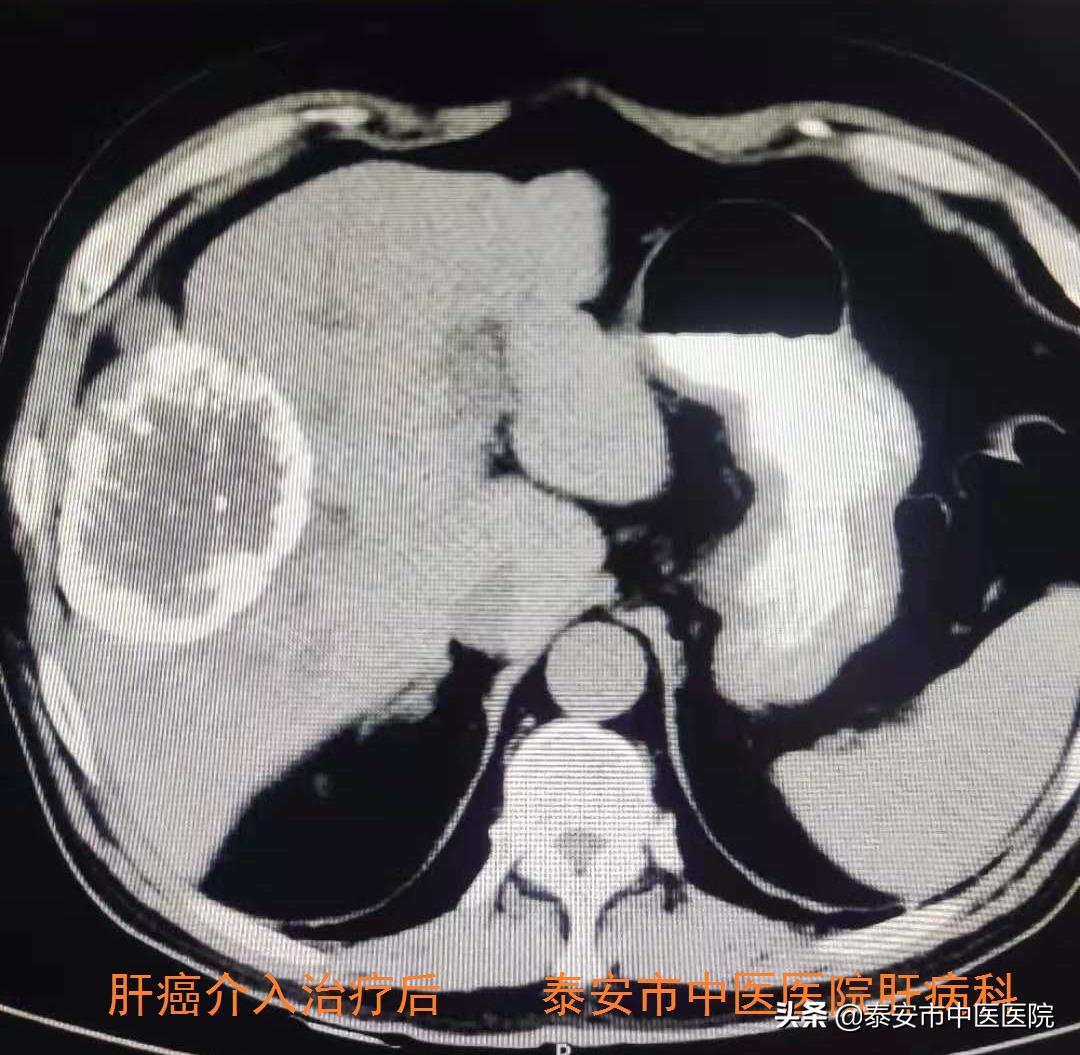 传承精华守正创新市中医医院,中医药大学第一附属医院肝病科