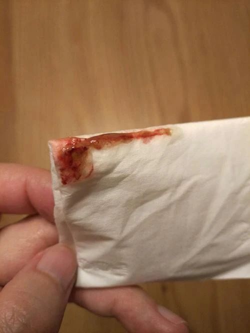 猫咪出现血便怎么办,家猫抓出血了怎样处理