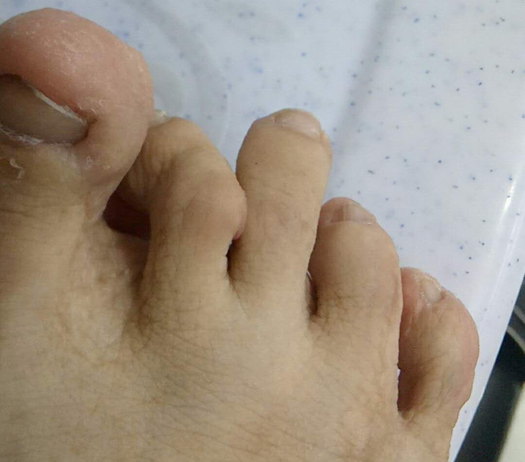 遗传病生的孩子,显性遗传病宝宝健康路线