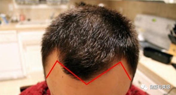 李易峰寸头窄额头,李易峰寸头怎么剪