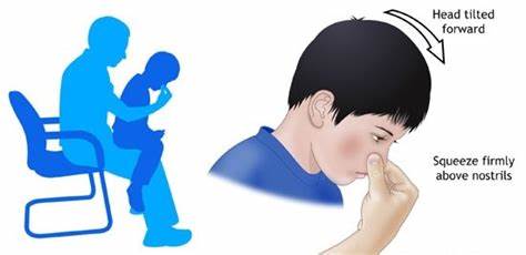 专业医生：冬季鼻出血就得这样处理，请收下这篇健康科普