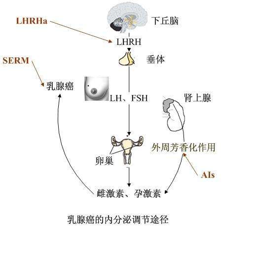 哪种类型乳腺癌适合做免疫治疗,哪种性质的乳腺癌用内分泌治疗