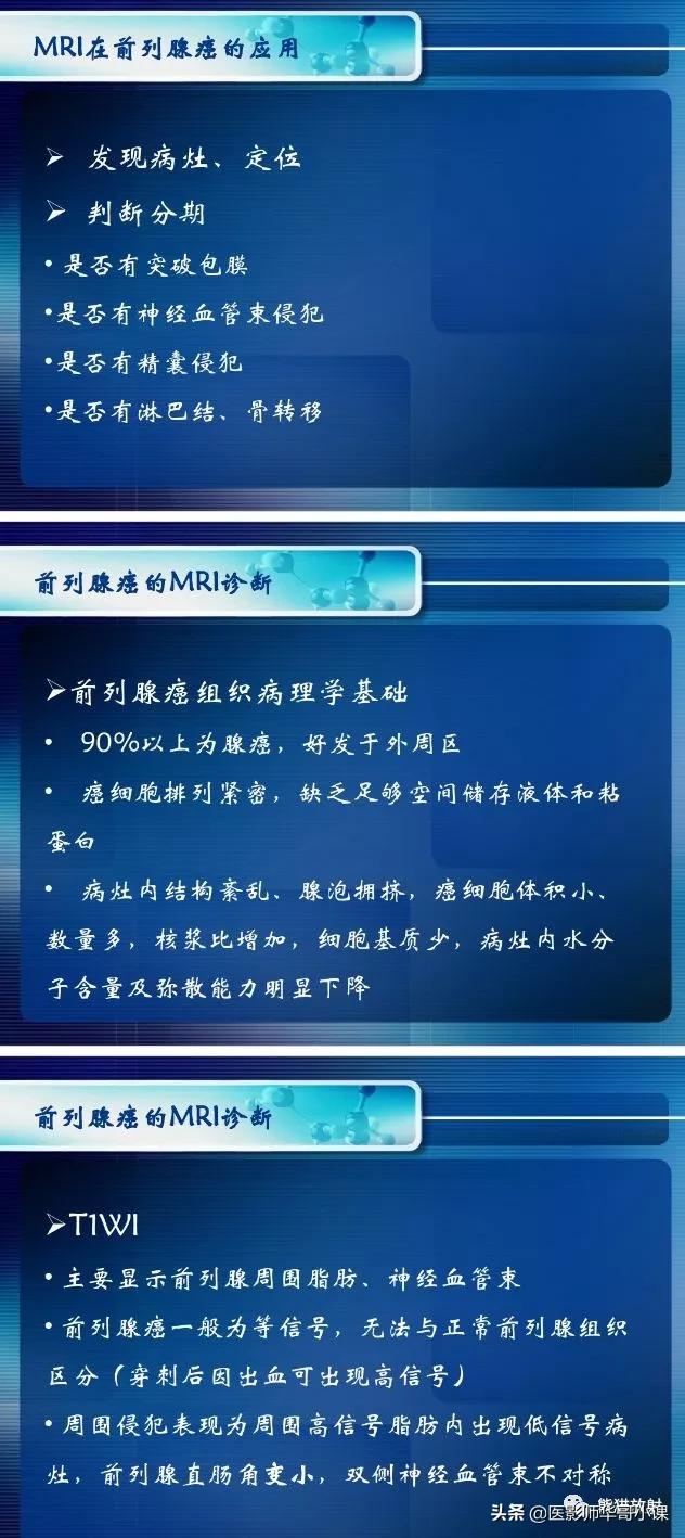前列腺磁共振影像解剖,前列腺mri正常诊断报告模板