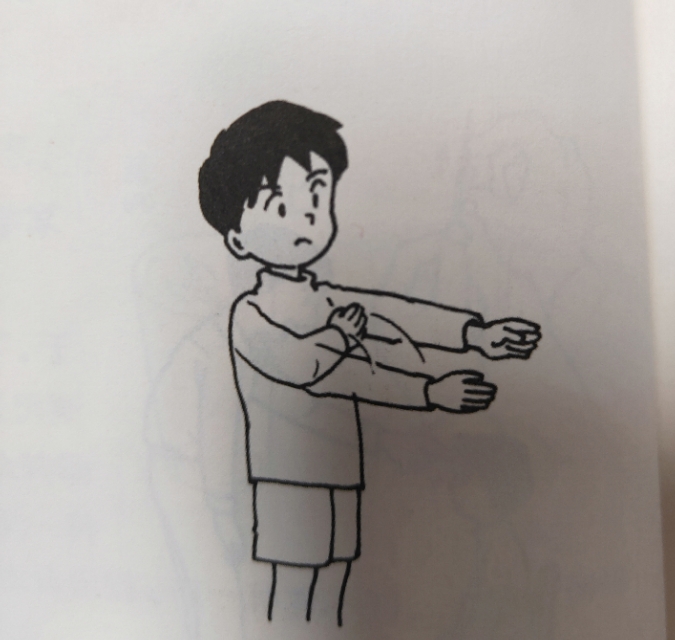 小孩的胳膊断了,儿子的手臂很细很瘦