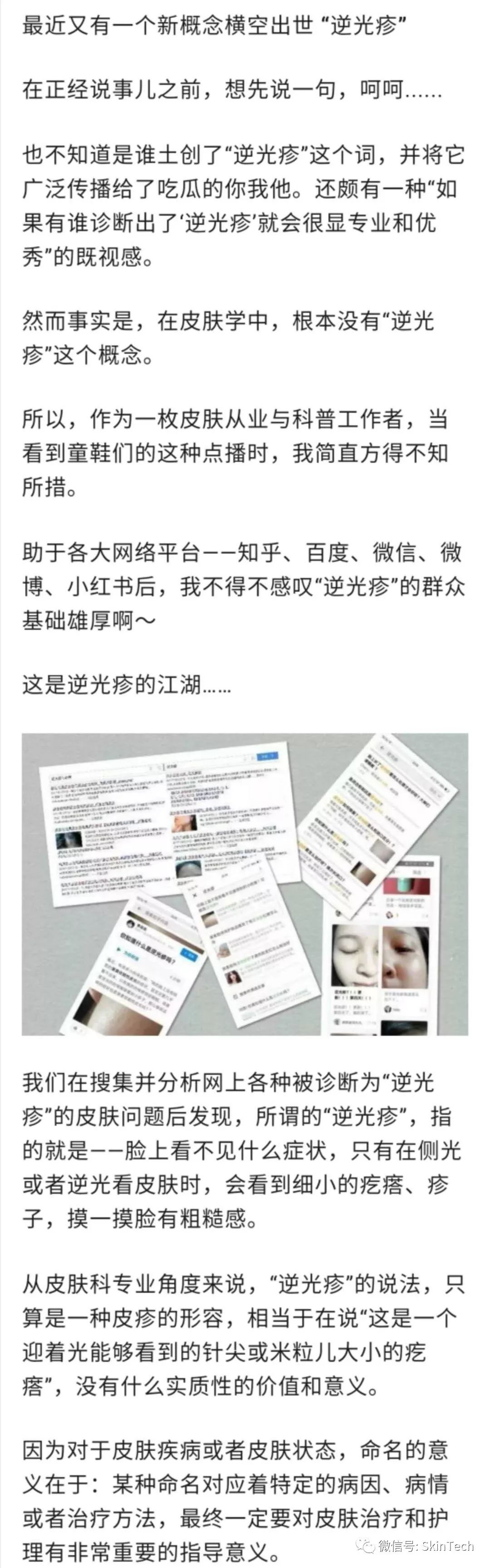 逆光疹是属于皮肤炎症吗,逆光疹是不是日光性皮炎