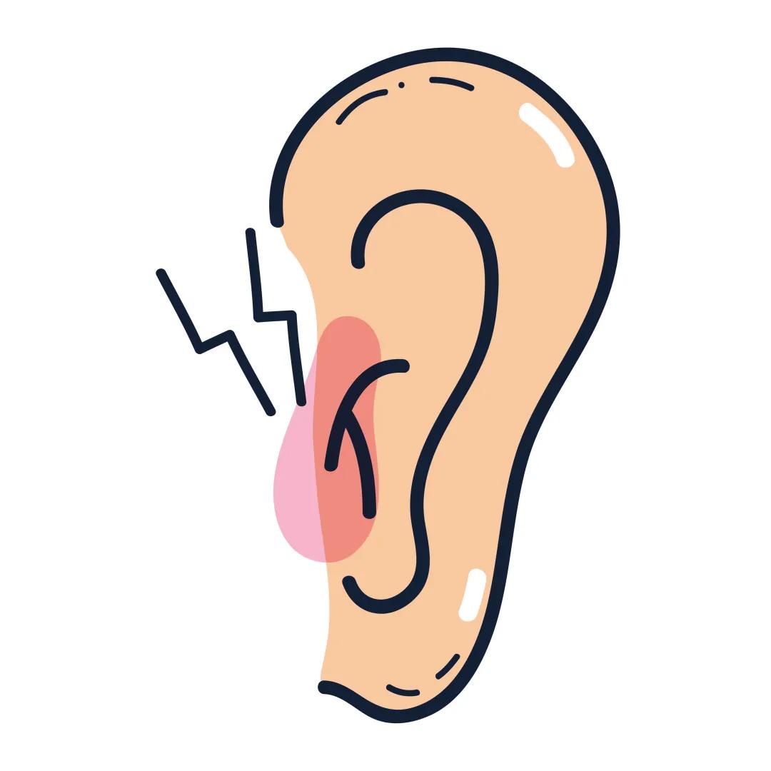 华西耳鸣专家郑芸在哪里坐诊,华西郑芸耳鸣治疗方法