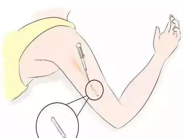 不想生三胎怎么避孕,不吃药最好的避孕方法