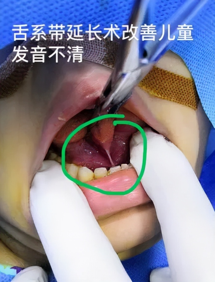 孕妇有牙病可以治吗,备孕牙齿上药需要关注啥