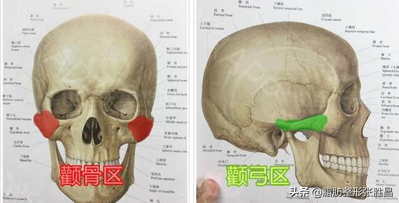 颧骨突出显凶怎么改善,脸凹显凶