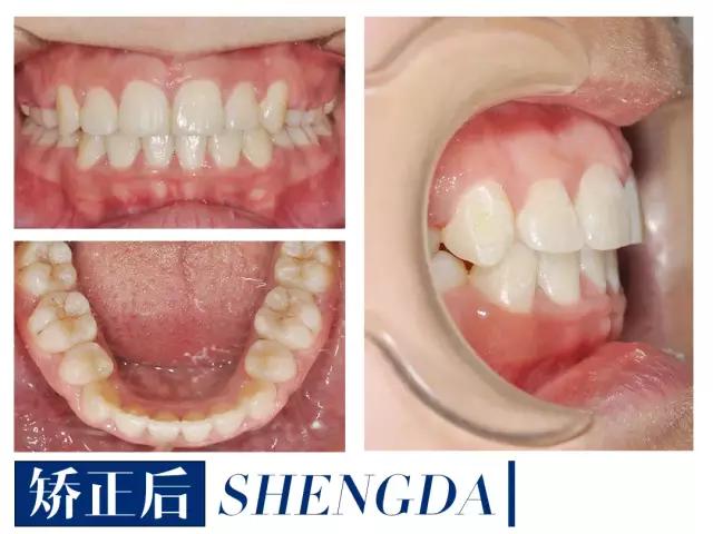 山西“爱马仕”级别齿科医院！get明星同款笑容