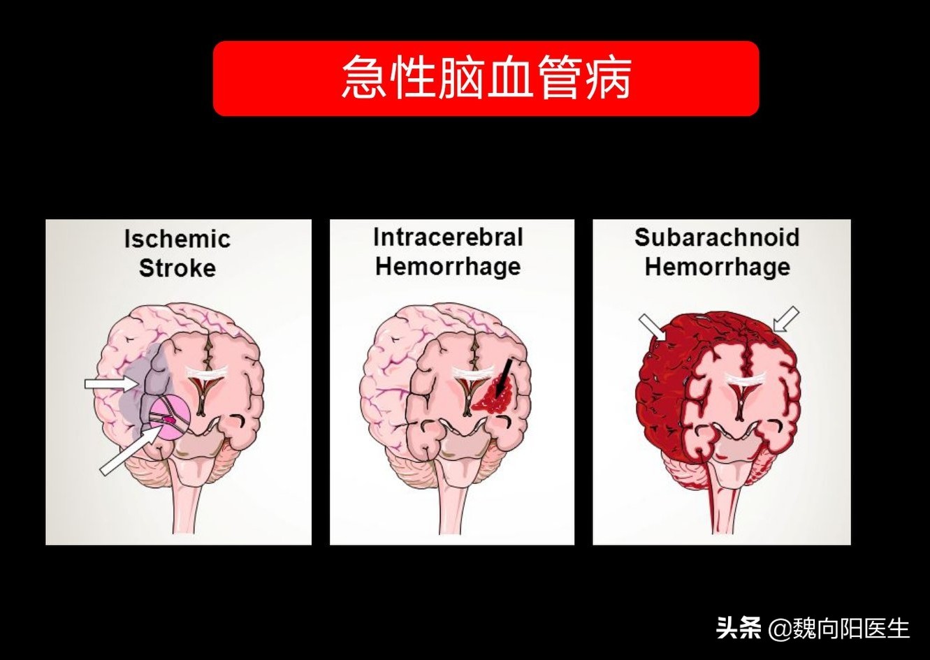 脑供血不够头晕输液用什么药,头晕眩晕需要输液吗