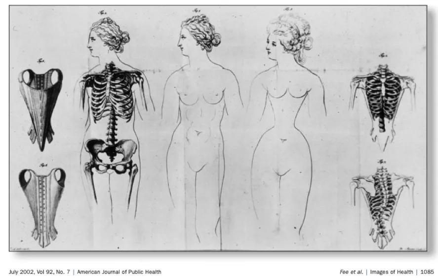 女星为了收腰裙把自己送进医院？为了美这么拼，不值当