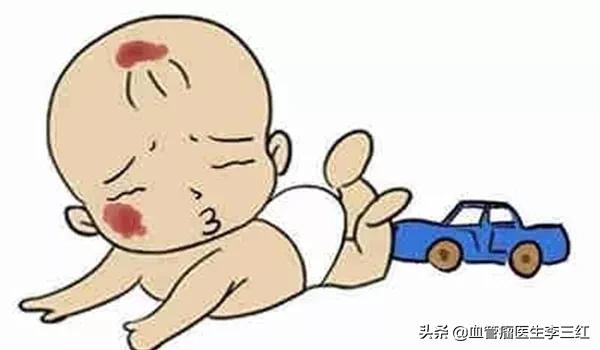 胎记越早处理还是越晚处理比较好,哪些胎记必须去除