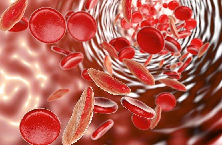 贫血导致的头晕症状怎么缓解,贫血晒太阳是不是会头晕