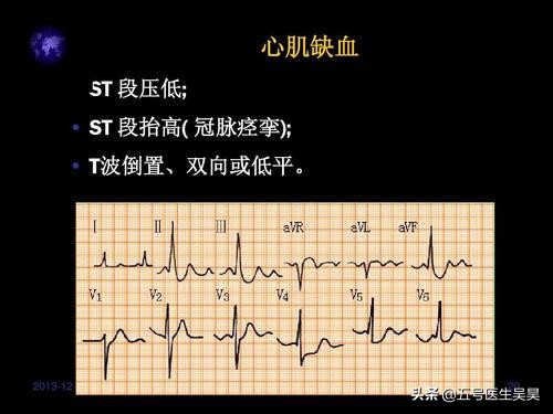 无痛胃镜检查前的准备和关注事项,无痛肠胃镜做之前需要关注什么