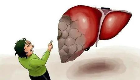 慢性胆管炎中医能治愈吗,原发性胆汁性胆管炎能彻底治愈吗