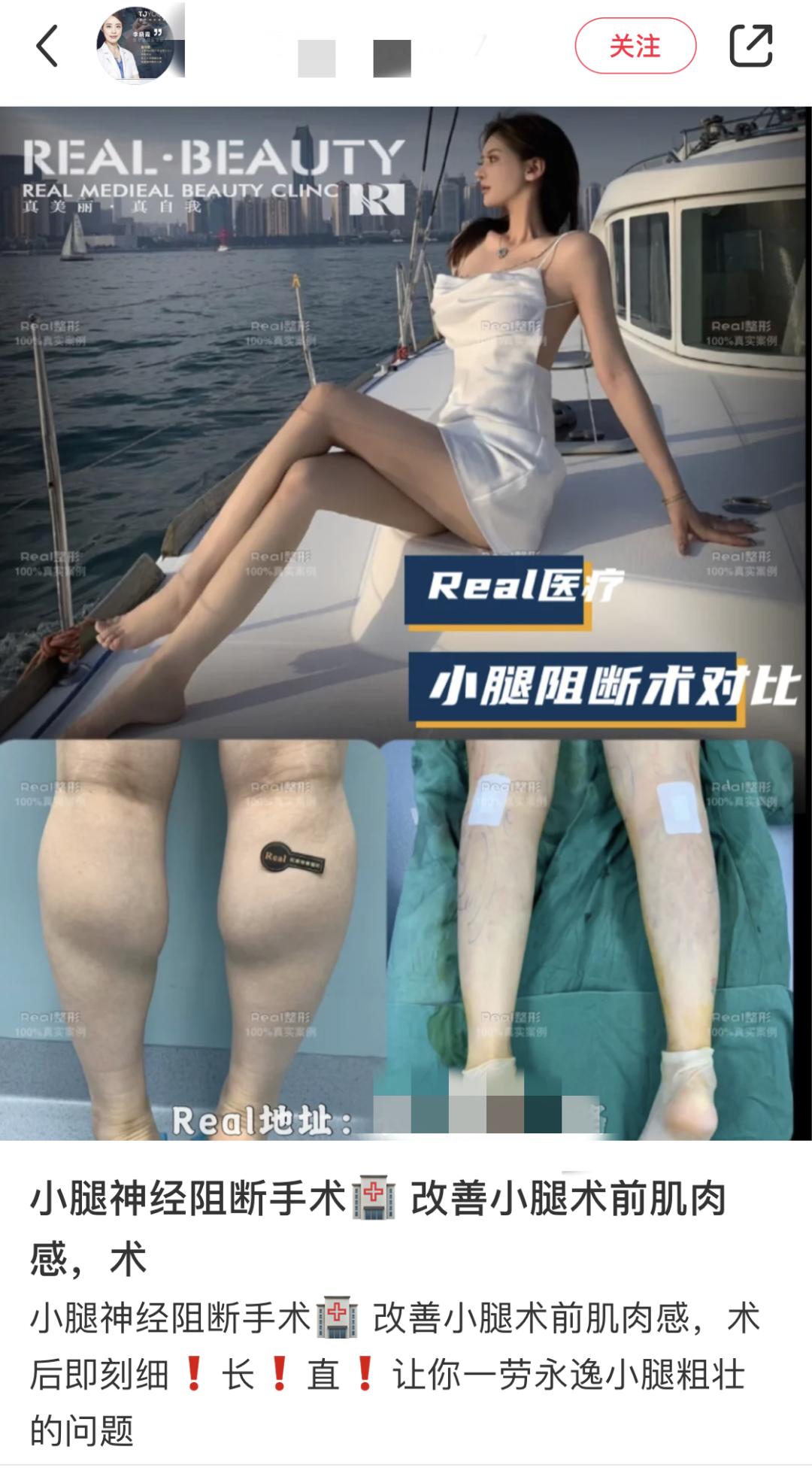 直接看呆，谁能拦住这不要命的“美”人