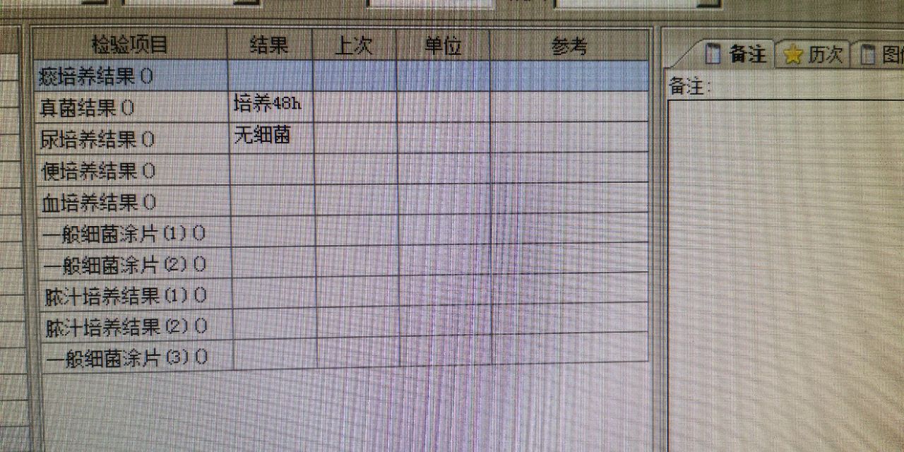 中西医结合治疗原因不明肠梗阻、腹水转氨酶明显升高病案一例！