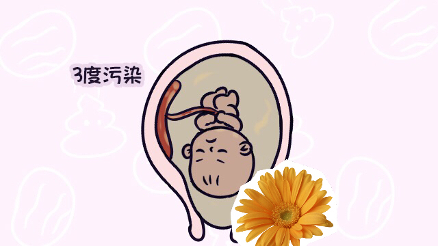 孕后期怎样保证羊水清澈,高位破水剖腹产羊水清澈