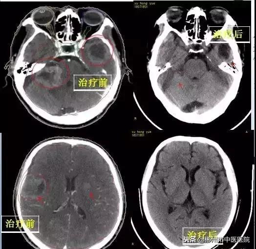 死神推我走陀螺拖我回