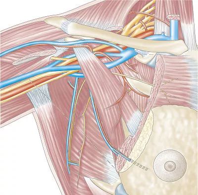 手发麻是颈椎的问题还是风湿,手麻疼是冰冷的是什么原因