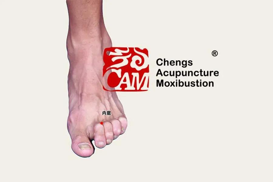 程凯针灸治疗糖尿病,程凯糖尿病讲座视频