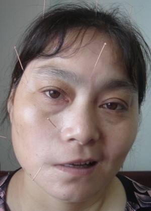 灏忎腑椋庝腑鍖昏兘鏍规不濂藉悧,涓尰娌绘剤浜嗗皬涓