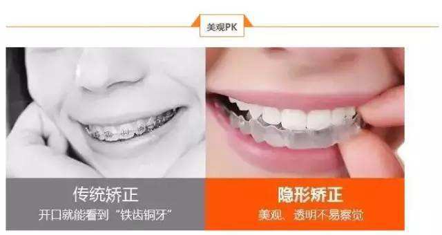 成年后牙齿矫正一般需要多少钱,牙齿矫正大概要花费多少钱成年人