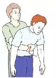 异物卡喉咙海姆立克急救法,食物呛入气管海姆立克解决妙招