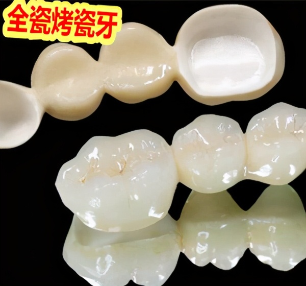 牙科医生讲义第十四讲：什么是 全 瓷 冠