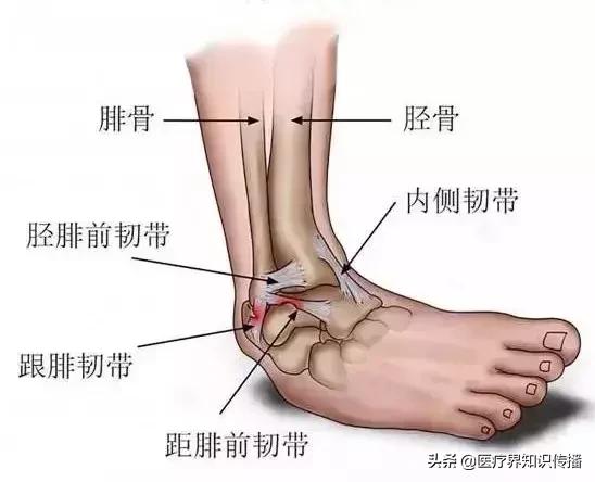 老是崴脚是怎么解决,总是崴脚纯手法教你怎么治疗