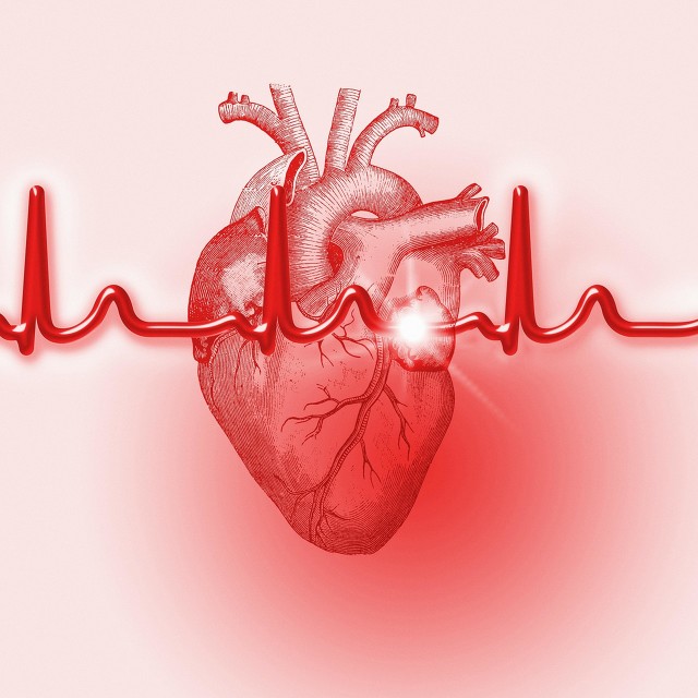 冠脉造影后用不用放支架我来告诉你评判标准，以后不用犹豫了