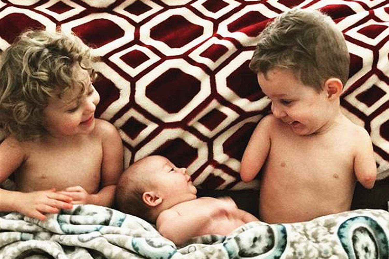 宝宝出生就没有双手双脚，原因在于父母，如何预防胎儿畸形