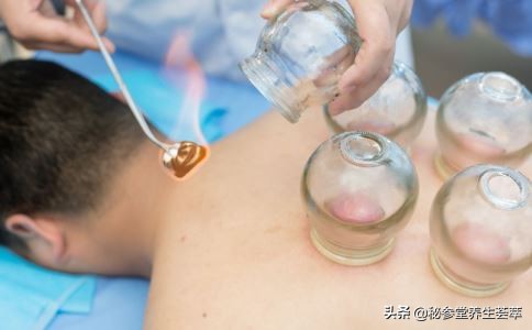 拔罐关注什么多长时间拔一次,自己在家拔罐需要关注什么