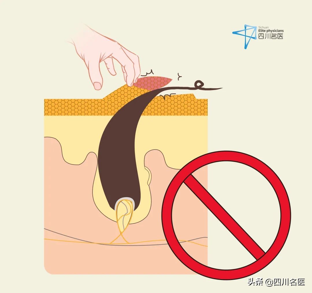 鸡皮肤太丑怎么办啊,鸡皮肤太丑怎么处理好看