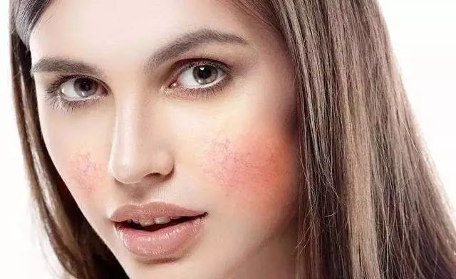 脸起皮干燥紧绷刺痛发红？这三个敏感肌护理误区你一定要远离