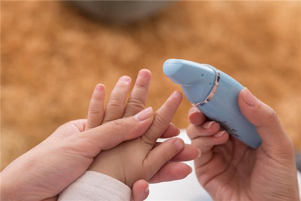 濂舵按鍙互绁涢櫎瀛╁瓙鐨勮儙璁板悧,澶╃敓榛戝▋濞冨彉鐧藉皬绐嶉棬