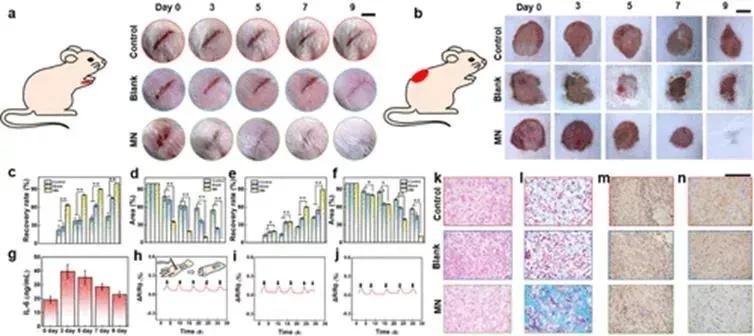 南京工业大学：一种可实现伤口智能管理的微针敷料