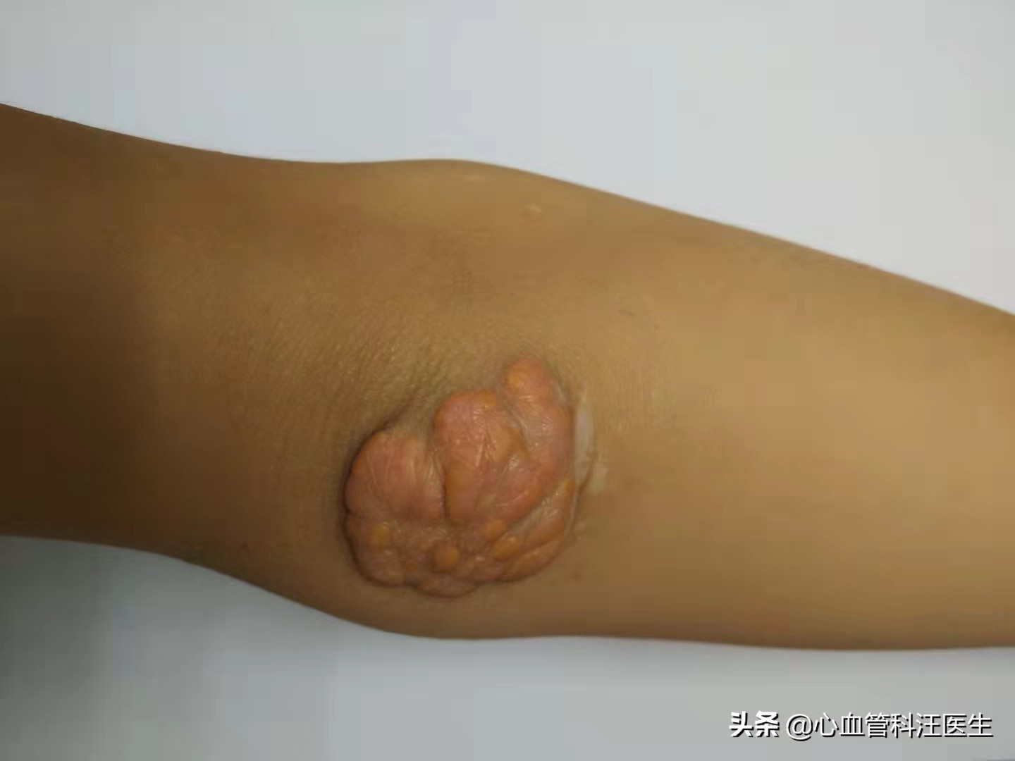 一个发霉的橘子热评,一个发霉的橘子