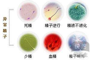 精子质量检测深度学习,精子质量检测怎么做