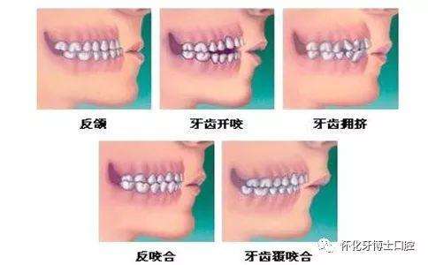 医生为什么问是否接受拔牙,医生为什么要我们拔牙