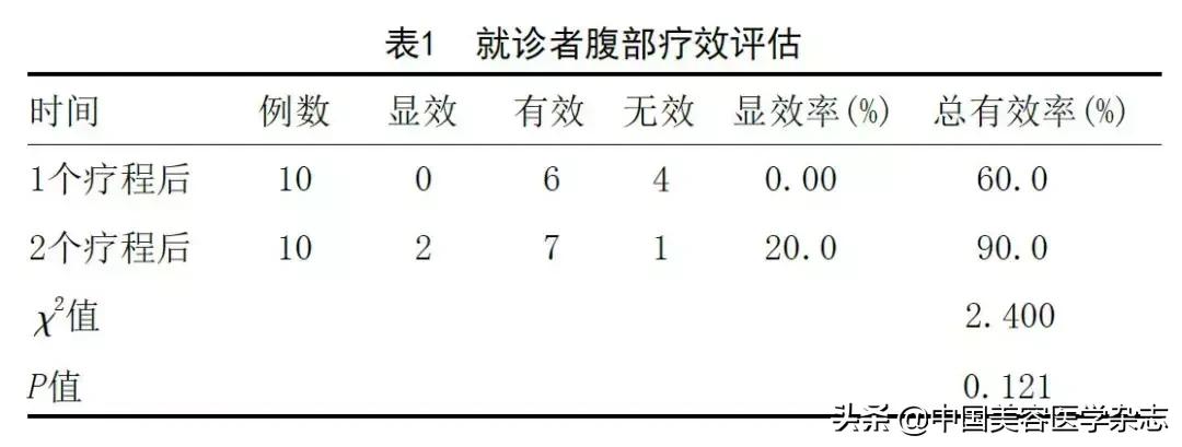 射频双极,射频综合治疗仪
