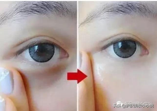 美容护肤小窍门甩掉黑眼袋,护肤小手法减少眼细纹减轻眼袋